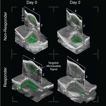 Imagen: Imágenes 3-D de Ultrasonido Molecular (USMI) de xenoinjertos pancreáticos respondedores y no respondedores antes (día 0) y después (2 días) del tratamiento. La imagen en escala de grises muestra un volumen del tumor y tejido circundante. La región verde es la señal molecular (Fotografía cortesía de la Universidad de Carolina del Norte).